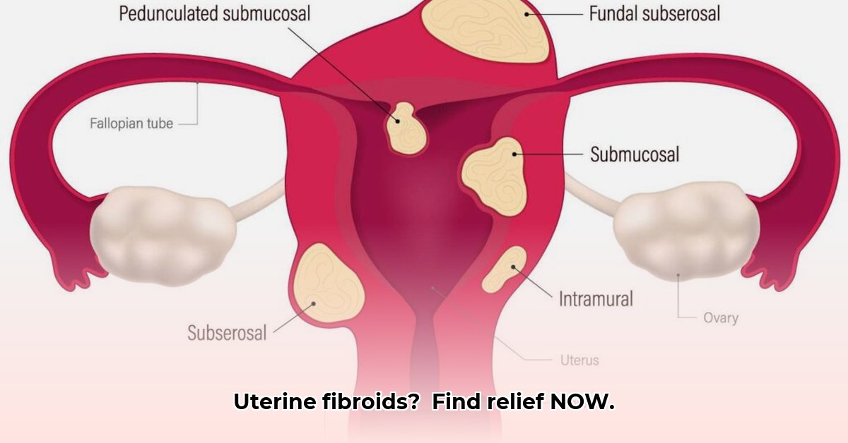 fibroids-meaning